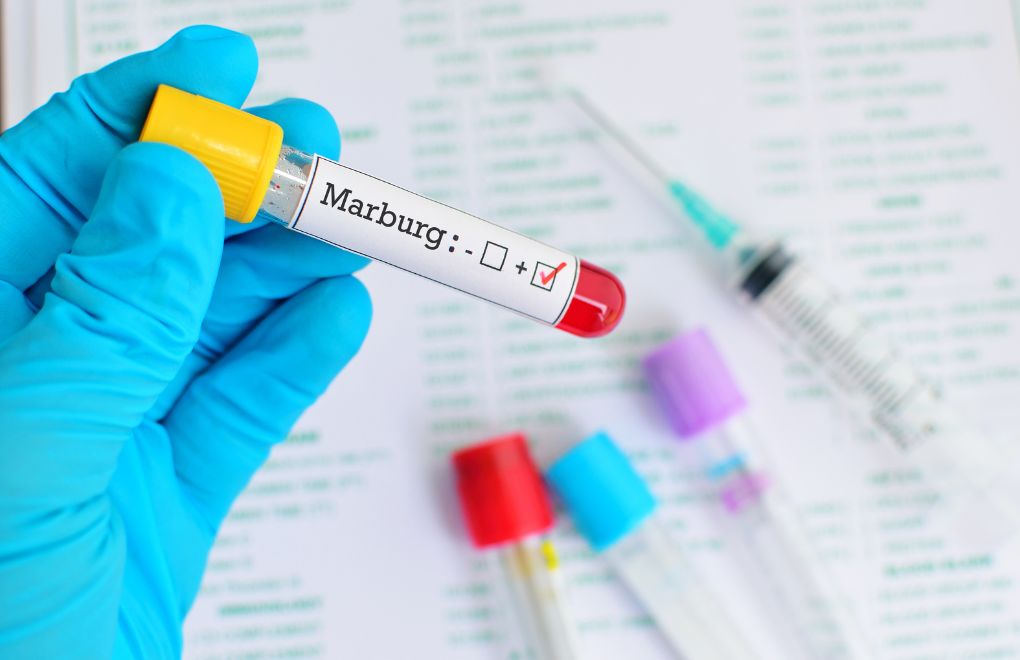 Marburg Virüsü İle İlgili En Çok Merak Edilenler
