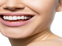 Diş Eti Hastalıklarına Yol Açan 7 Neden